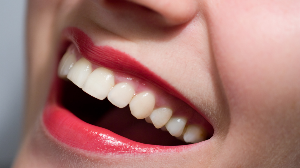 Smile makeover dentist