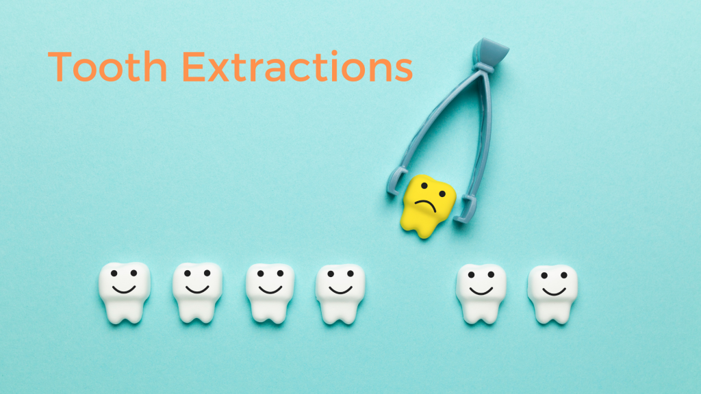 Tooth Extraction
