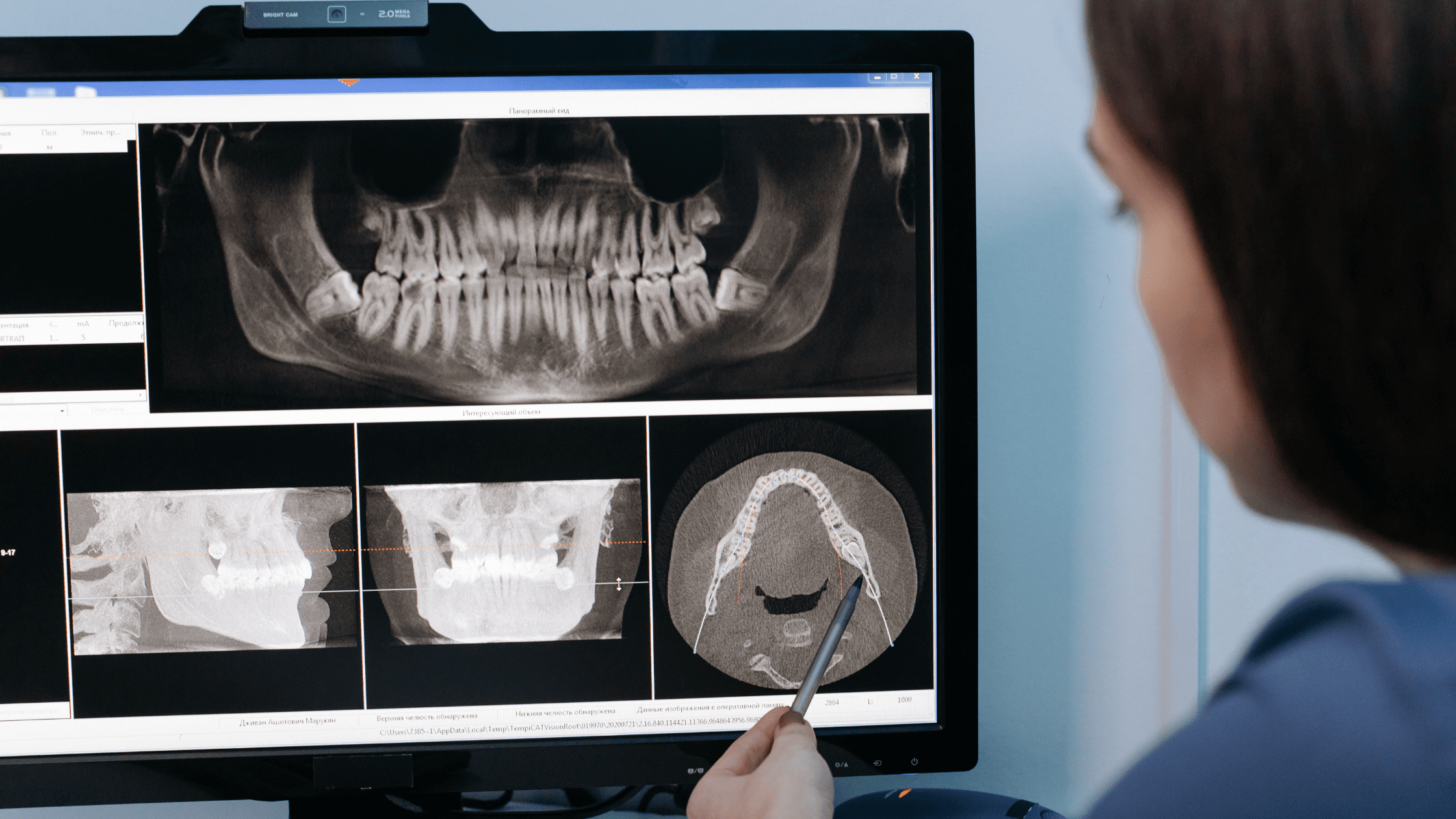 Woman reviewing dental implant case on a computer screen.